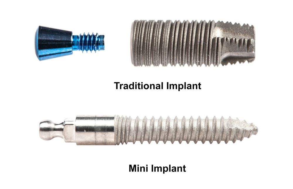 mini vs. traditional implants