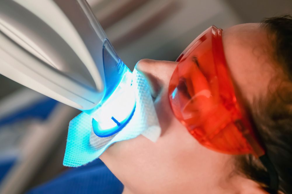 teeth whitening