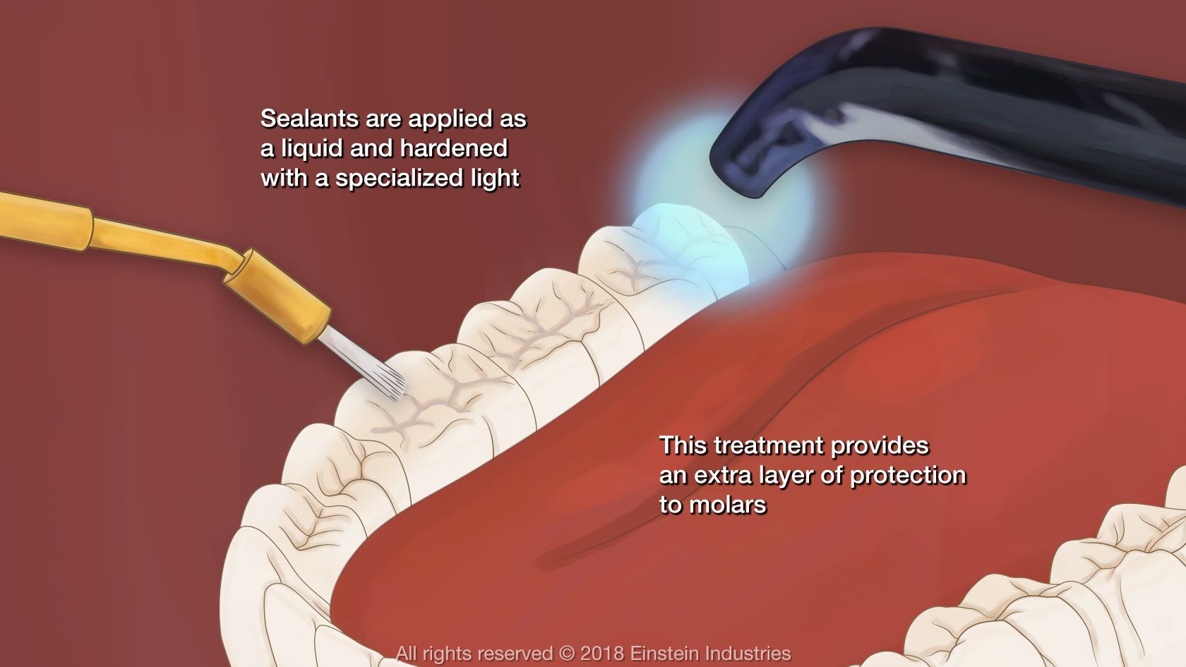 Illustration of sealants being applied and cured